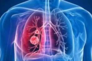 全球引發新冠肺炎HXQC再公告